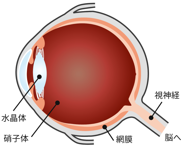 白内障について