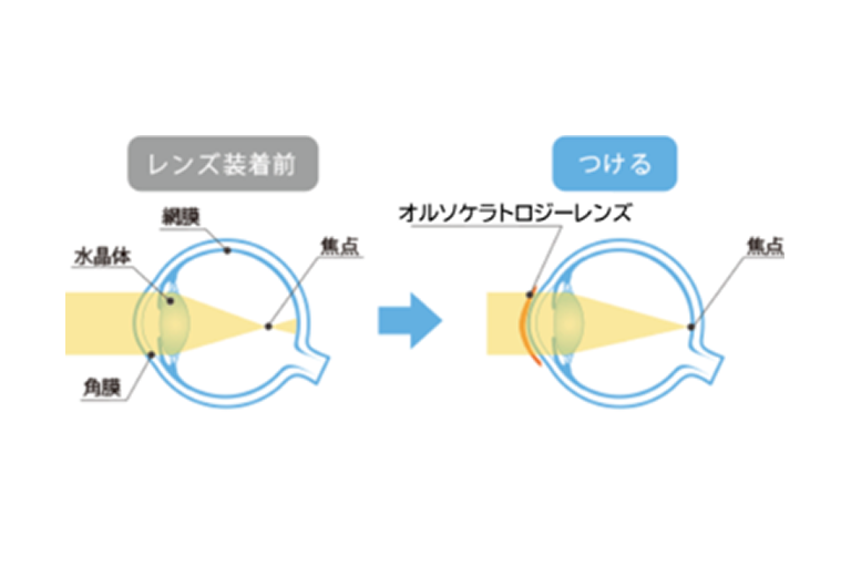 適応検査