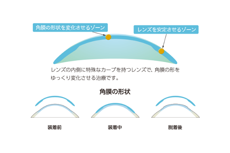 初回装着・練習